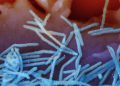 CDC issues simplified RSV vaccine guidance for seniors