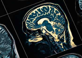 FDA approves Lilly’s new Alzheimer’s drug after delay