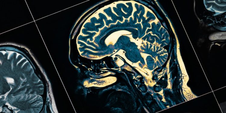 FDA approves Lilly’s new Alzheimer’s drug after delay