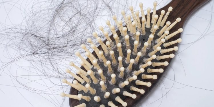 Researchers reverse hair loss caused by alopecia