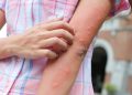 What to know about the mosquito virus spreading through New England