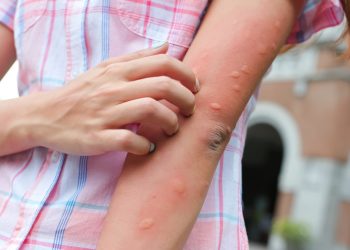 What to know about the mosquito virus spreading through New England