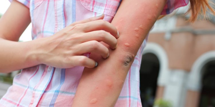 Fourth case of dangerous mosquito-borne virus confirmed in Massachusetts