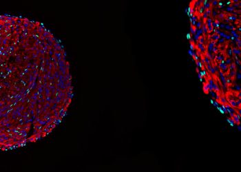 Breakthrough technique may help speed understanding, treatment of MD, ALS