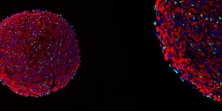 Breakthrough technique may help speed understanding, treatment of MD, ALS