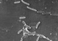 Superbugs could kill 40 million by 2050: Research