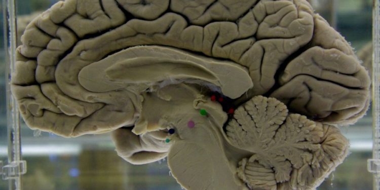 Scans show reorganization of brain during pregnancy