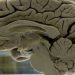 Scans show reorganization of brain during pregnancy