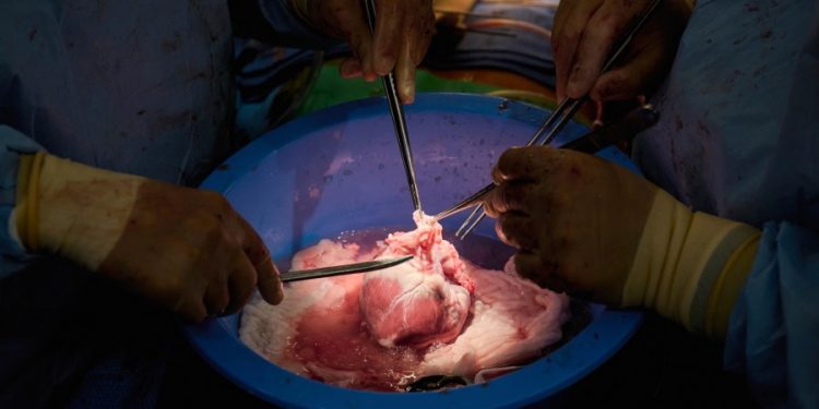 Surgeons implant new kind of engineered pig kidney