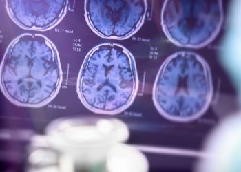 Dementia cases expected to double by 2060: Study