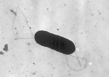 Listeria outbreak linked to prepared foods sickens at least 10