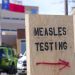 Canada has three times as many measles cases as US