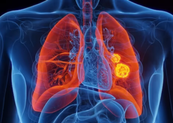 Air pollution may be raising risk of lung cancer in ‘never-smokers’: Study