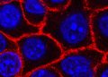 Promising vaccine may prevent certain cancers from returning