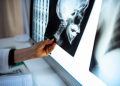 A setback to research that offered hope for fibrous dysplasia patients