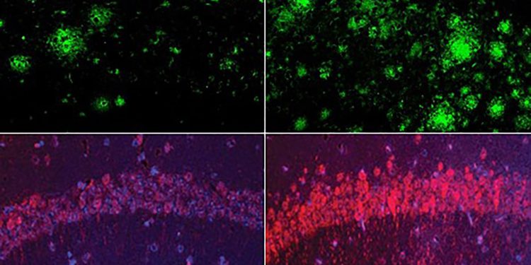 Could lithium explain — and treat — Alzheimer’s?