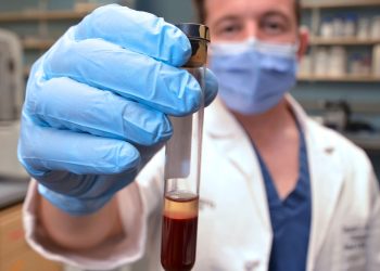 New blood test detects HPV-associated head and neck cancer 10 years early