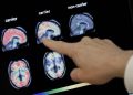 GLP-1s fail to slow progression of Alzheimer’s: Novo Nordisk