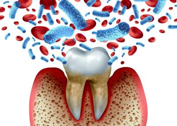 The gum disease, diabetes connection