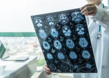 How a blood test can determine dementia risk