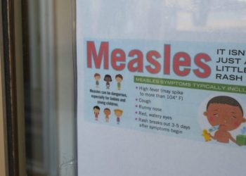 Measles case confirmed in Wisconsin