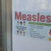 Measles case confirmed in Wisconsin