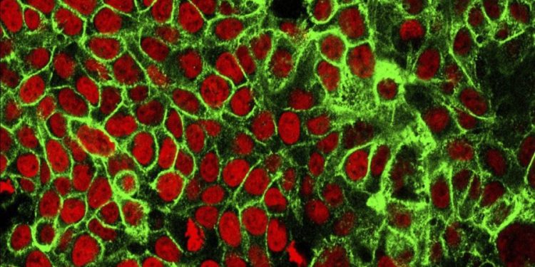 ‘Treatable, but not curable’: Mother warns others after stage 4 colon cancer diagnosis at 33