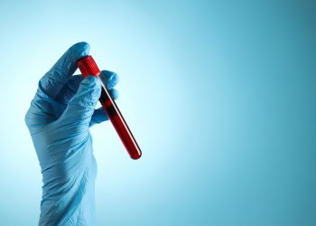 Blood test has potential to detect earliest signals of Alzheimer’s disease