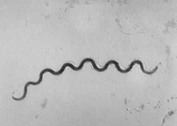 Syphilis making a comeback, health officials warn. CDC map shows where risk is highest
