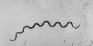 Syphilis making a comeback, health officials warn. CDC map shows where risk is highest