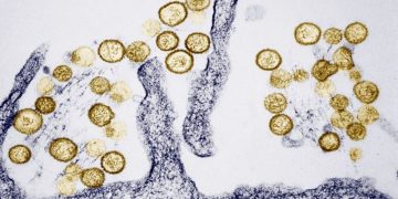 Hantavirus: Where the rare, sometimes deadly disease has been found in the US