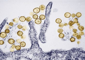 What causes hantavirus in the US?