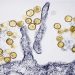 What causes hantavirus in the US?