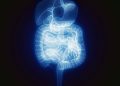When stress is a punch to the gut