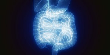 When stress is a punch to the gut