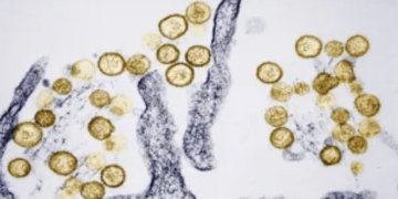 Fatal Colorado hantavirus case not linked to cruise ship, officials say
