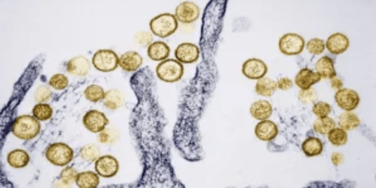 Fatal Colorado hantavirus case not linked to cruise ship, officials say
