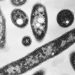 Third person dies amid NYC Legionnaires’ outbreak, officials say