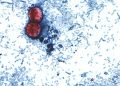 Another cyclospora outbreak not linked to lettuce under investigation: FDA