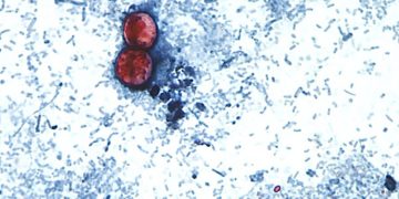 Another cyclospora outbreak not linked to lettuce under investigation: FDA