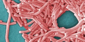 Fifth death reported in NYC Legionnaires’ outbreak