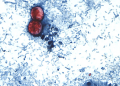 CDC: Nearly 7,000 cases of cyclosporiasis being investigated