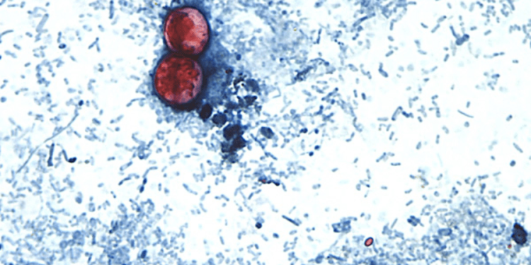 CDC: Nearly 7,000 cases of cyclosporiasis being investigated