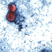 CDC: Nearly 7,000 cases of cyclosporiasis being investigated