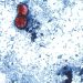 Why cyclospora can be deadly for some people