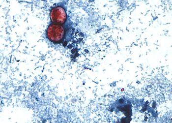 Cyclospora outbreaks with no confirmed sources grow: FDA