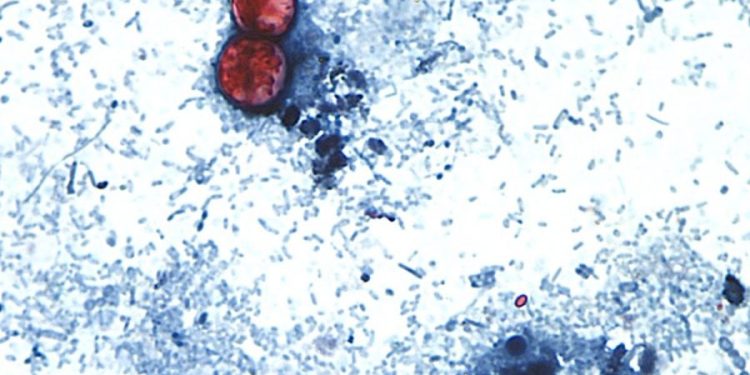Cyclospora outbreaks with no confirmed sources grow: FDA