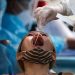 COVID is ‘growing’ in nearly every state, CDC reports. Here’s where levels are highest