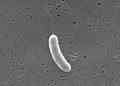 3rd person dies from flesh-eating bacteria in Florida