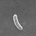 3rd person dies from flesh-eating bacteria in Florida